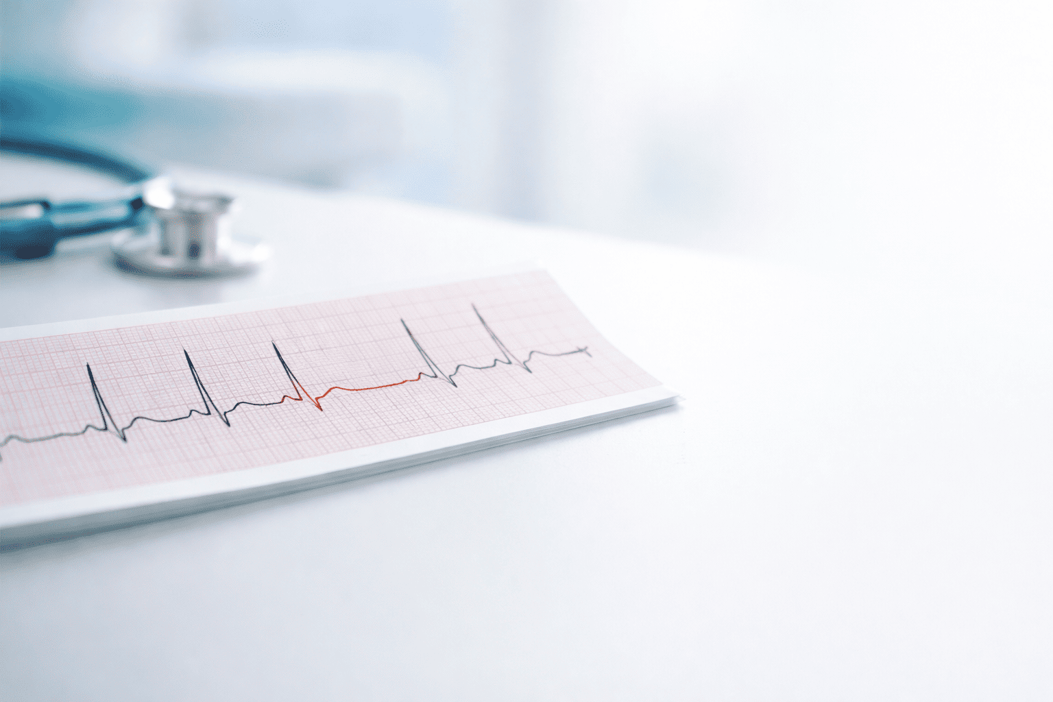 ST Segment Basics — Injury Current, Elevation, Depression (Beginner Framework)