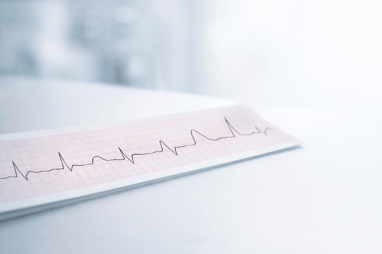 T Wave Basics — Normal Variants vs Pathology